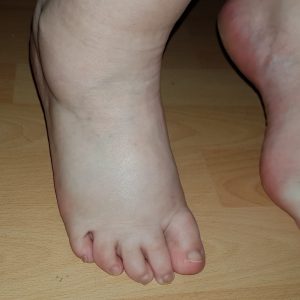 Pieds