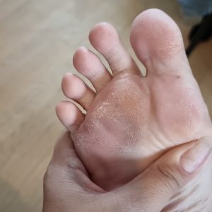 Pieds exclu première publication
