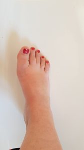 Pied vernis rouge
