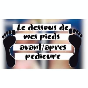 Le dessous de mes pieds AVANT/APRES pédicure 😋🦶🏻