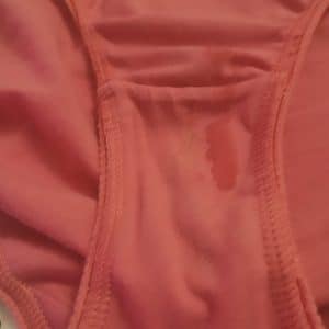 Culotte sale médaillée ! 4 août