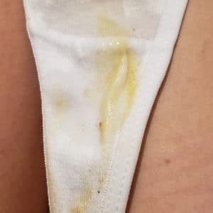 String dégueulasse- 36h