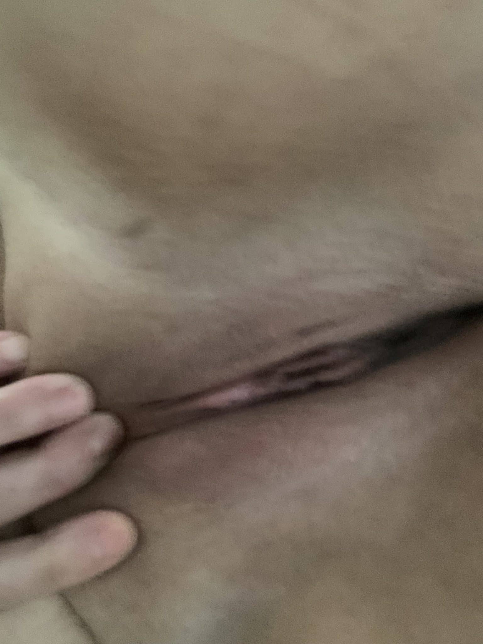 Eroseinlevres