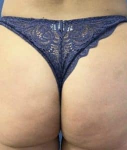 Petit string bleu