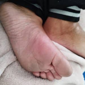 Photo de pieds sales