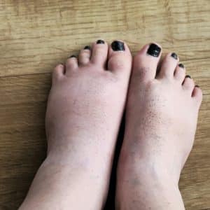 photo de mes pieds verni noir