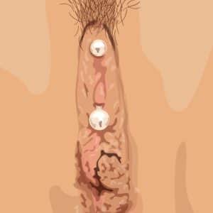 Mon piercing de clitoris
