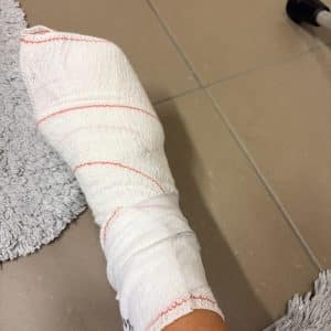 Bandage pied post op